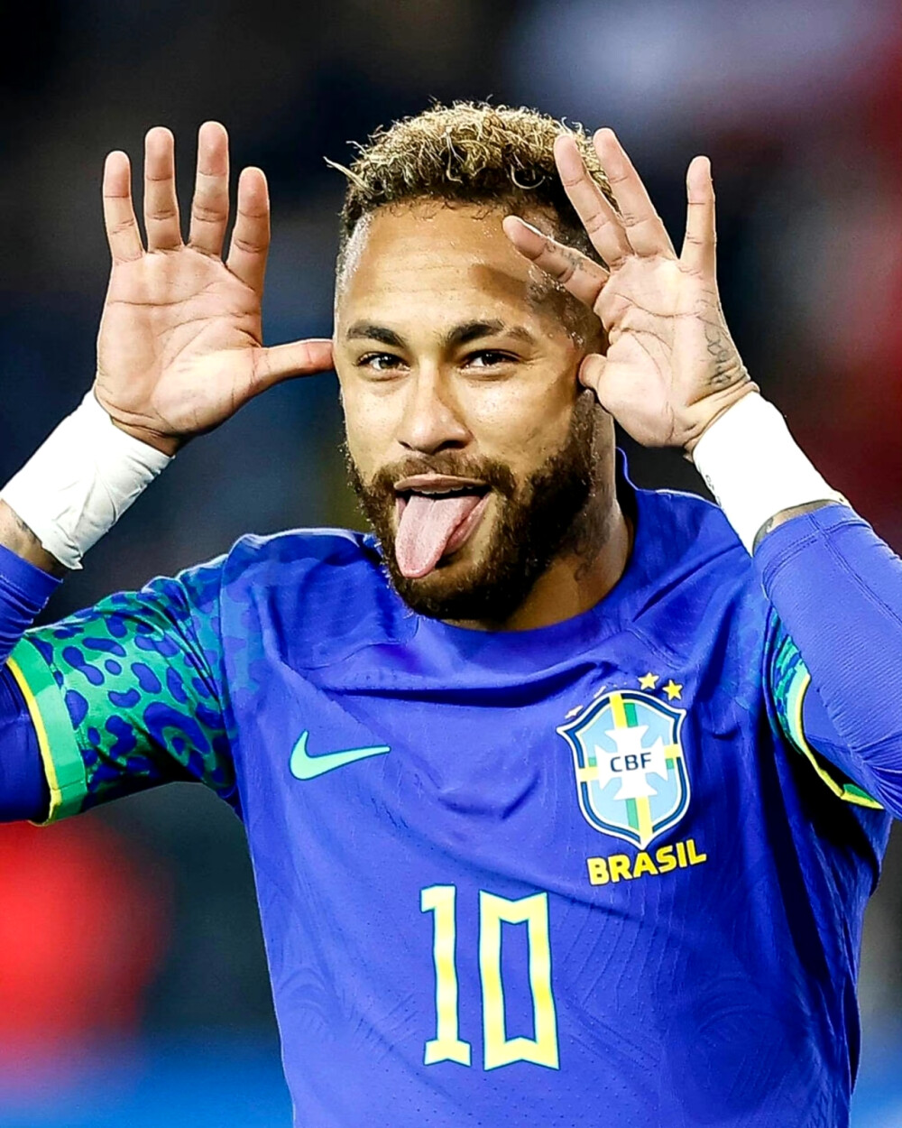 赛前被部分 赛前被部分